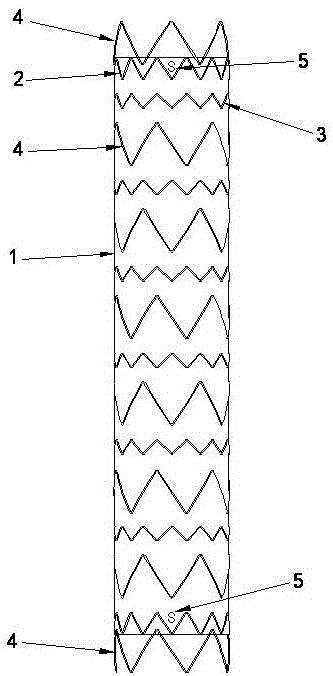 A kind of thoracic aortic stent graft