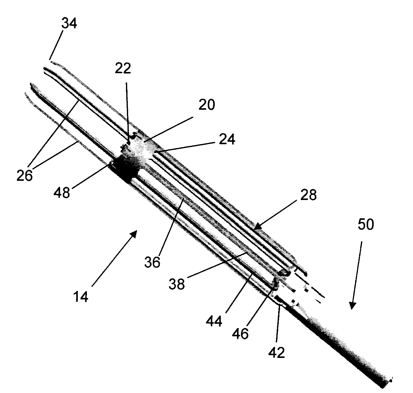 Delivery system, method, and anchor for medical implant placement
