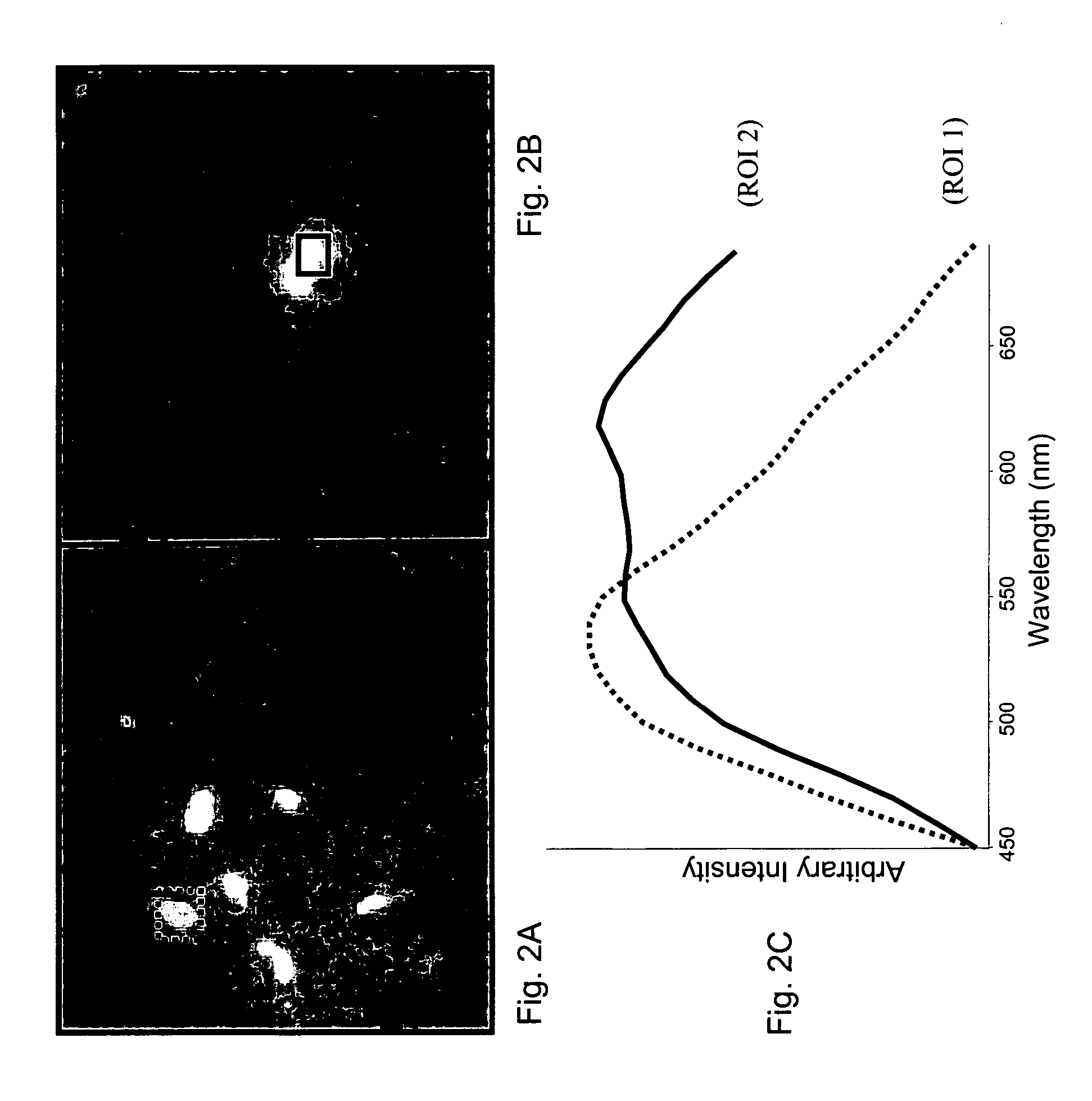 Raman spectral analysis of pathogens