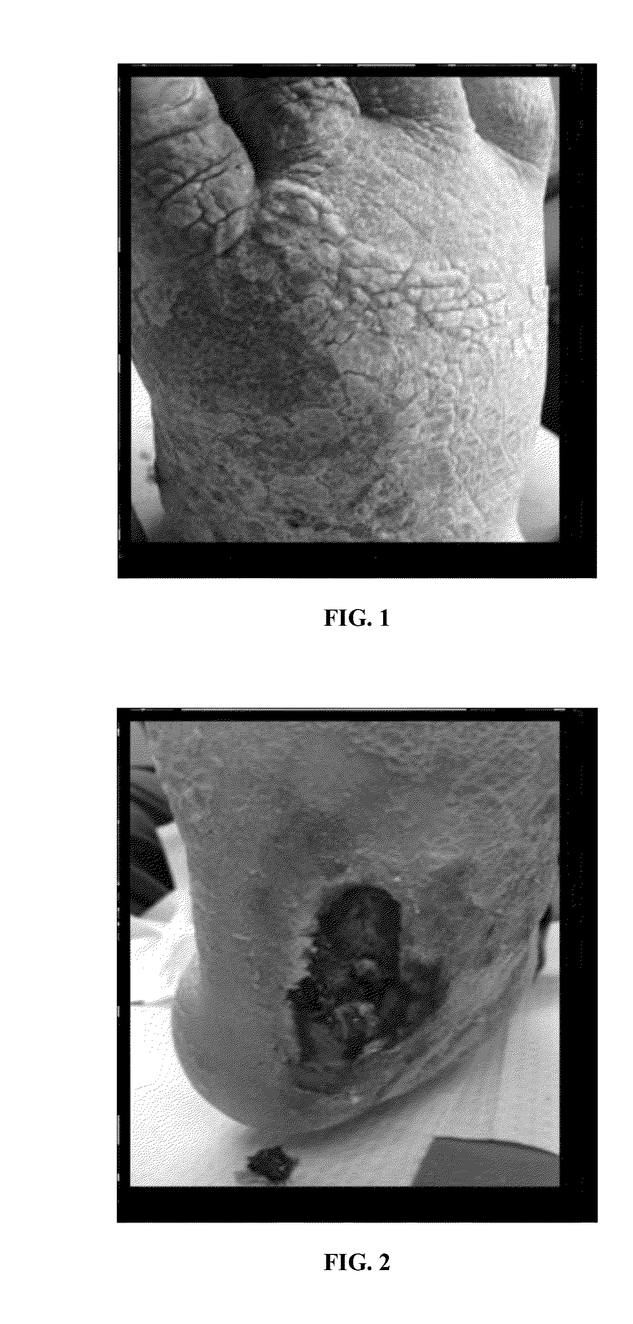 Method for making a topical composition comprising growth factors derived from human umbilical cord blood platelets