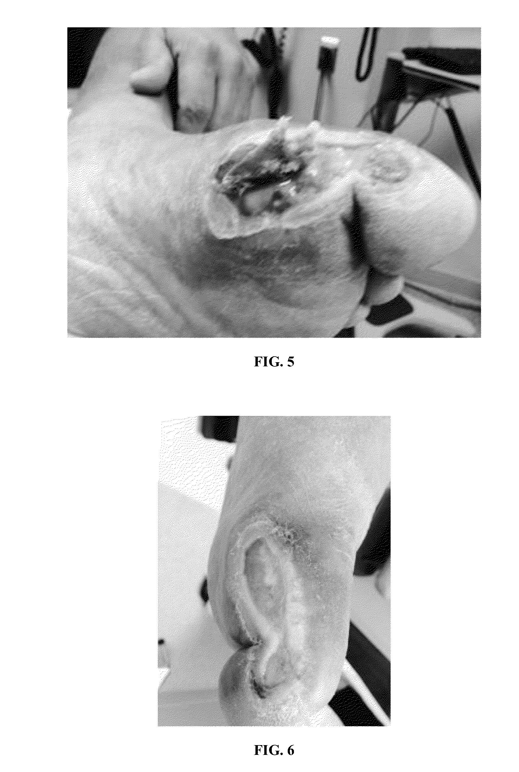 Method for making a topical composition comprising growth factors derived from human umbilical cord blood platelets