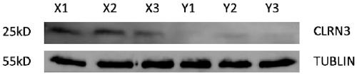 Application of CLRN3 protein as cell surface identification protein for separating X sperms