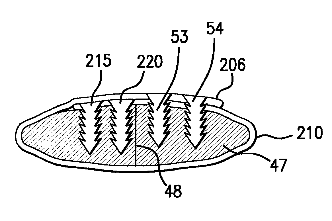 Bioabsorbable band system