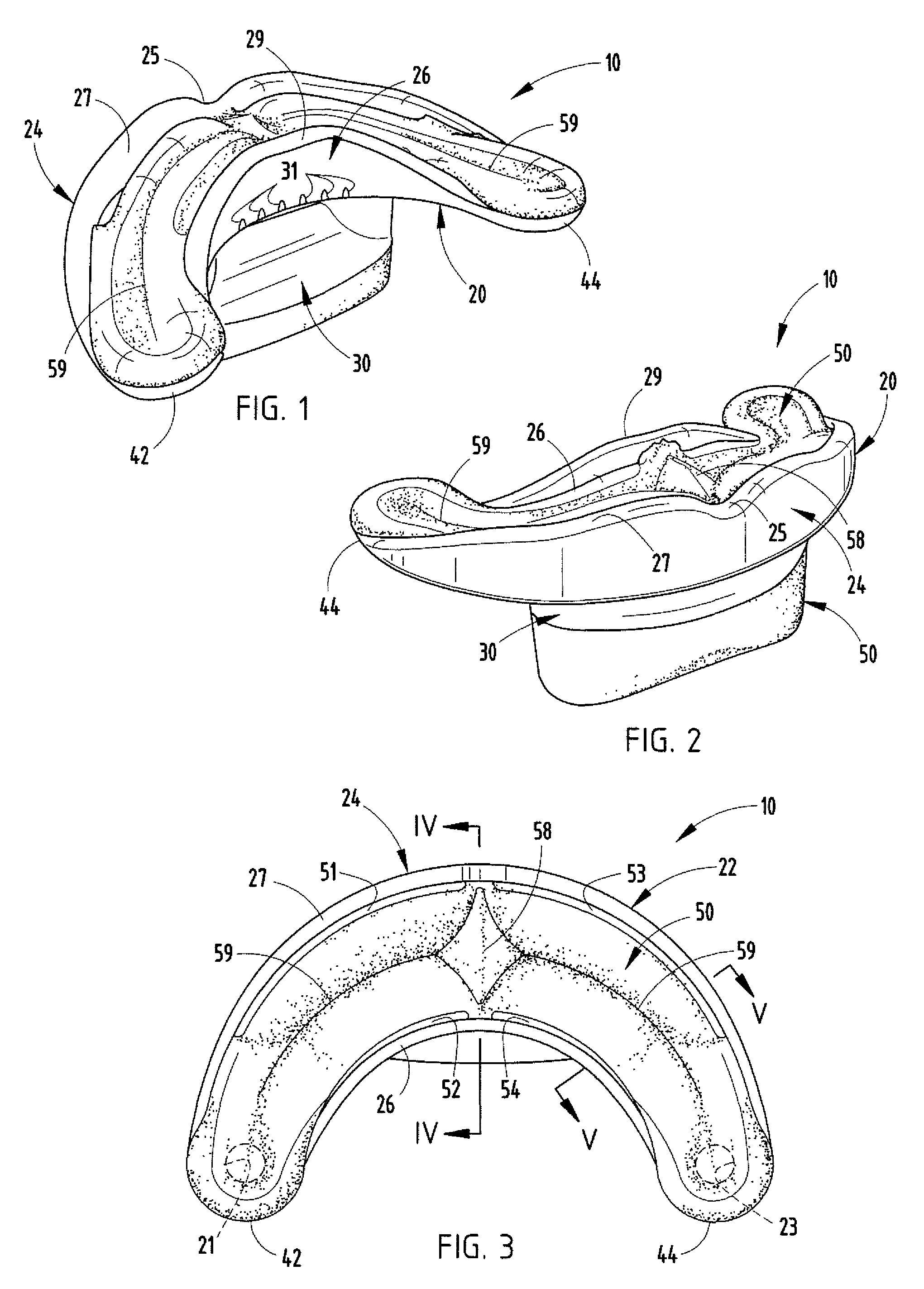 Oral orthosis handle