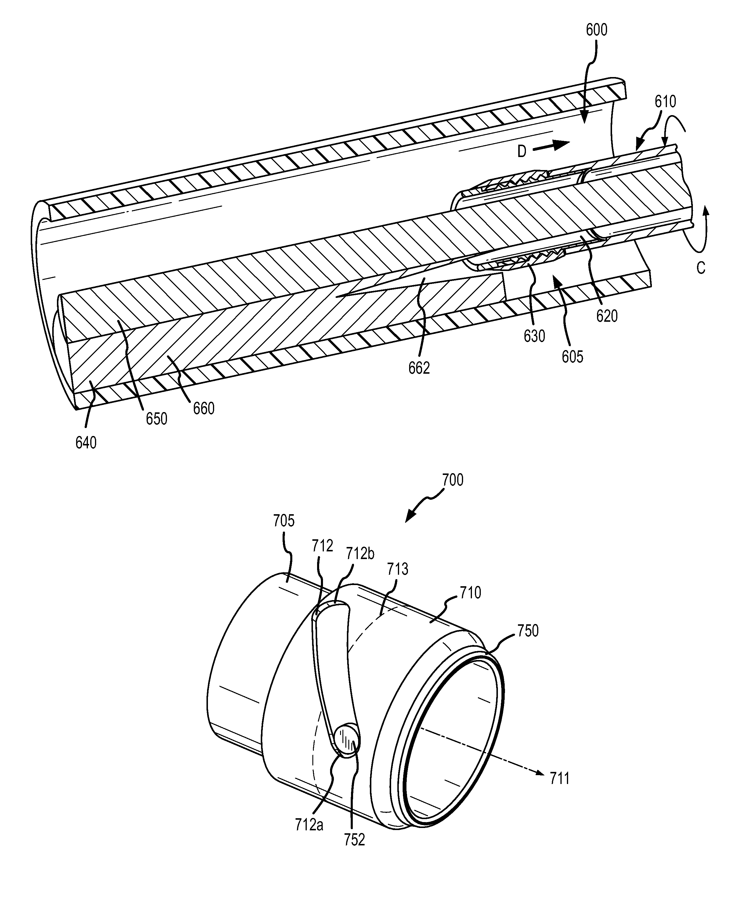 Retractable separating systems and methods