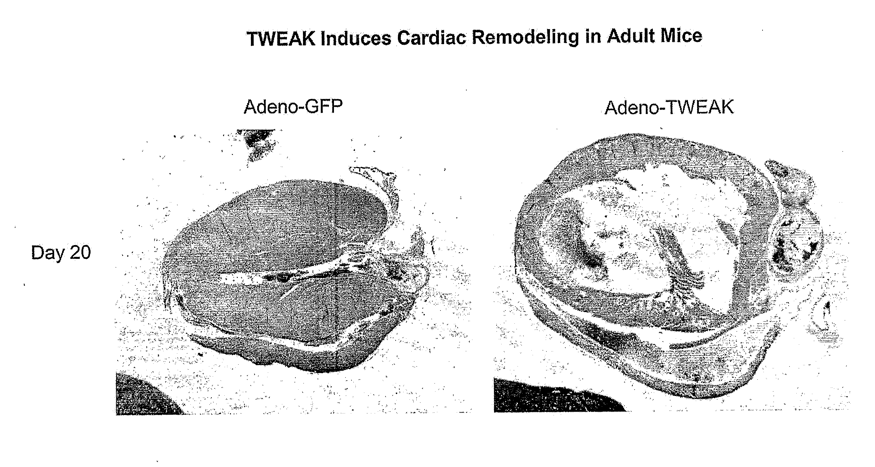 Methods for treating tweak-related conditions