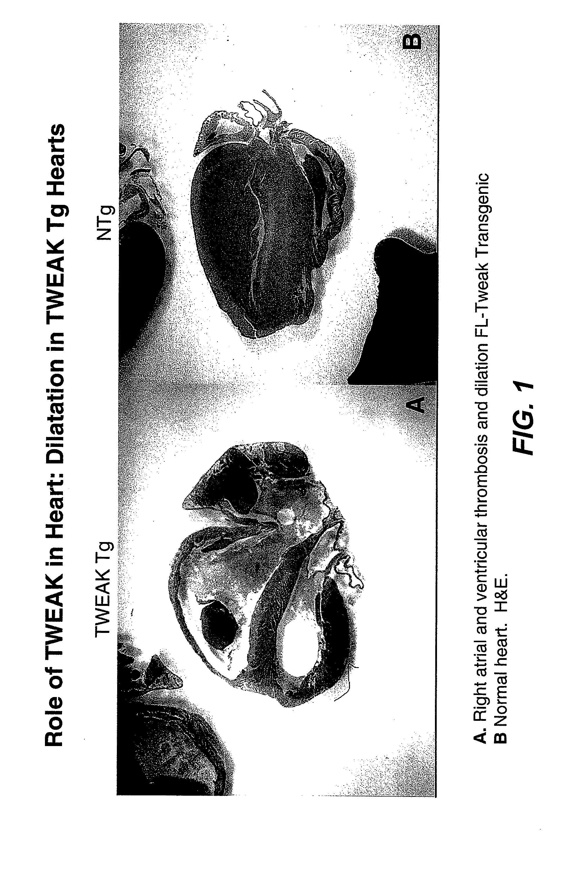 Methods for treating tweak-related conditions