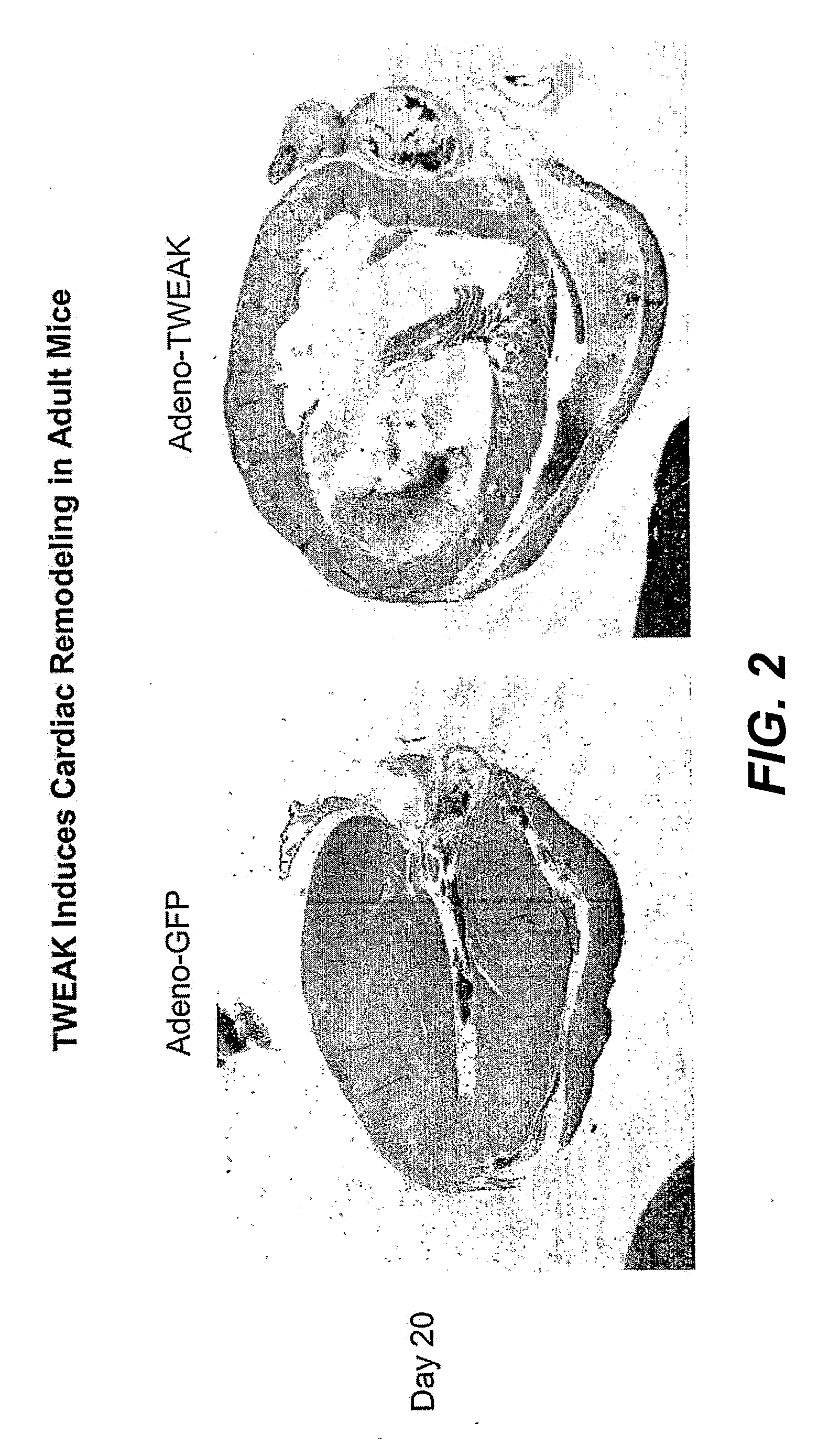 Methods for treating tweak-related conditions