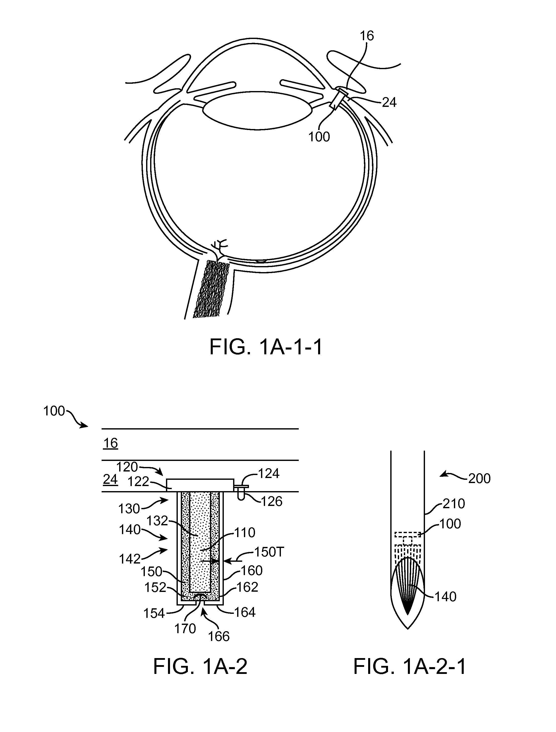 Combined drug delivery methods and apparatus