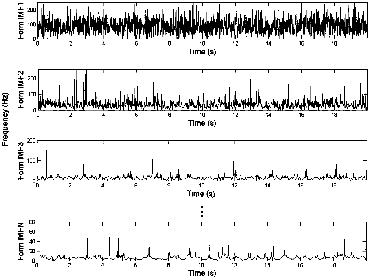 EEG signal classification model based on genetic algorithm and random forest