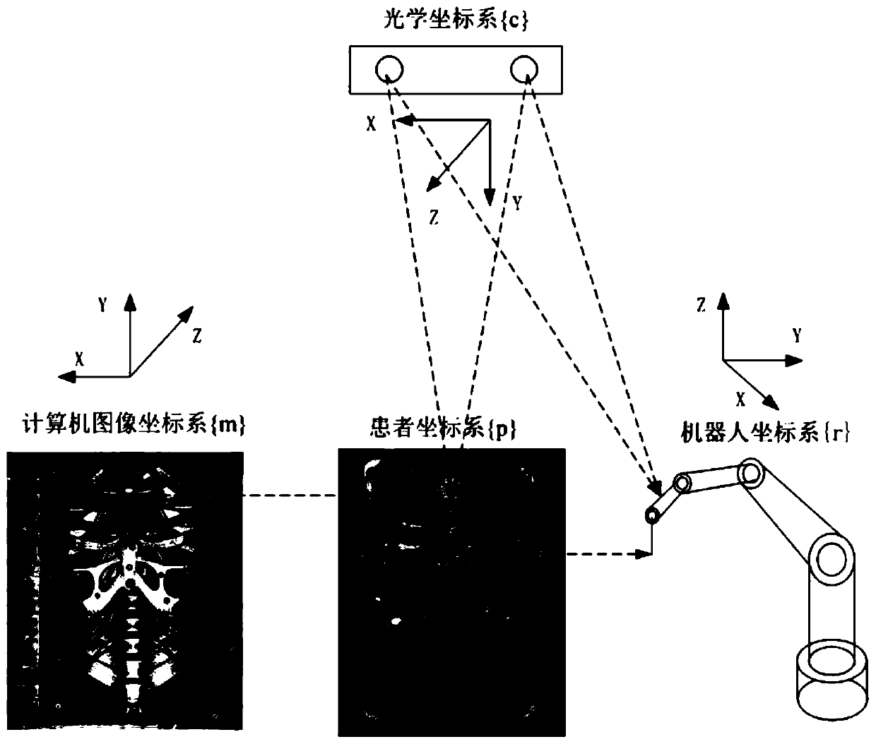 Puncture robot navigation system with dynamic compensation function based on binocular vision