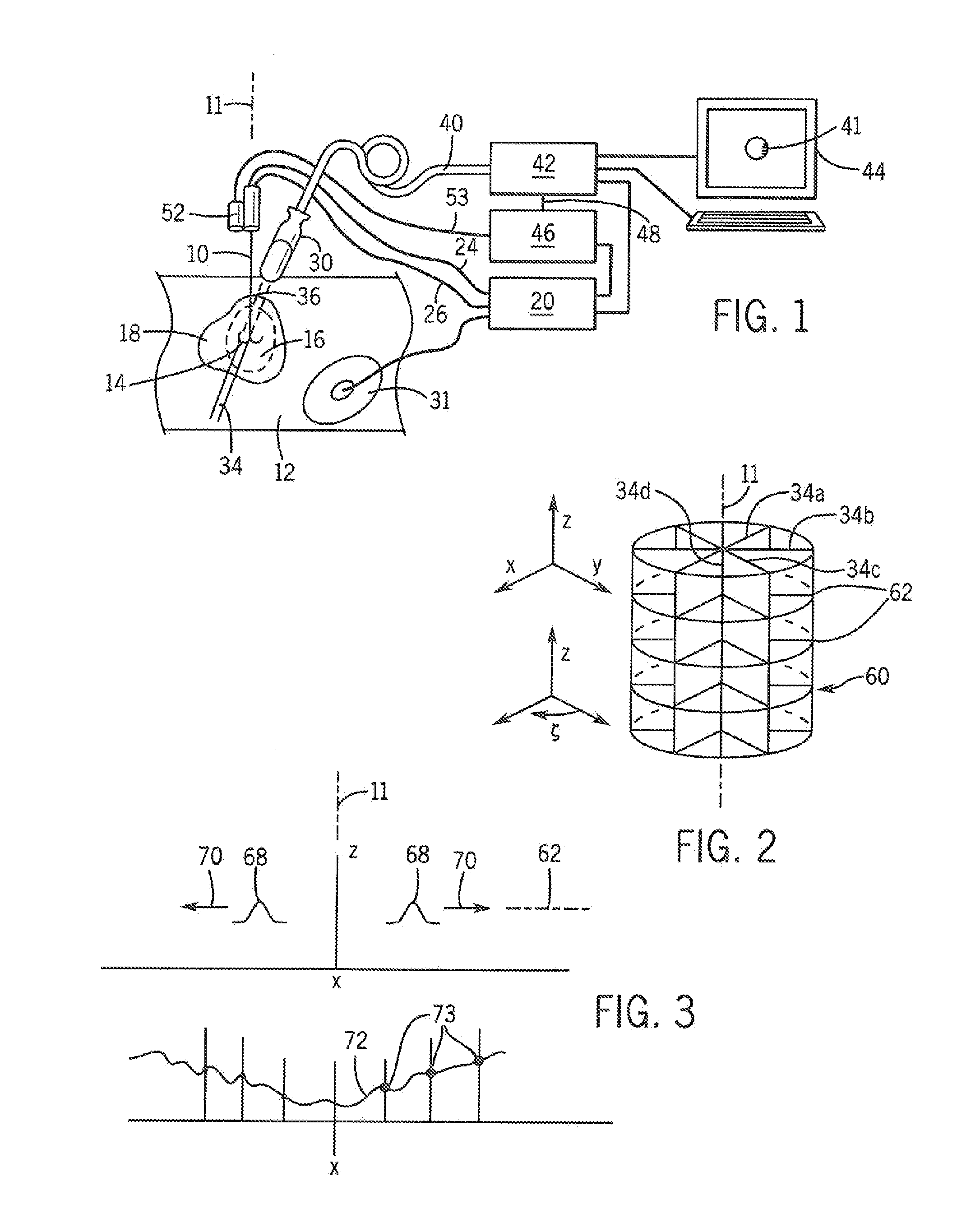 Method and Apparatus for Rapid Acquisition of Elasticity Data in Three Dimensions