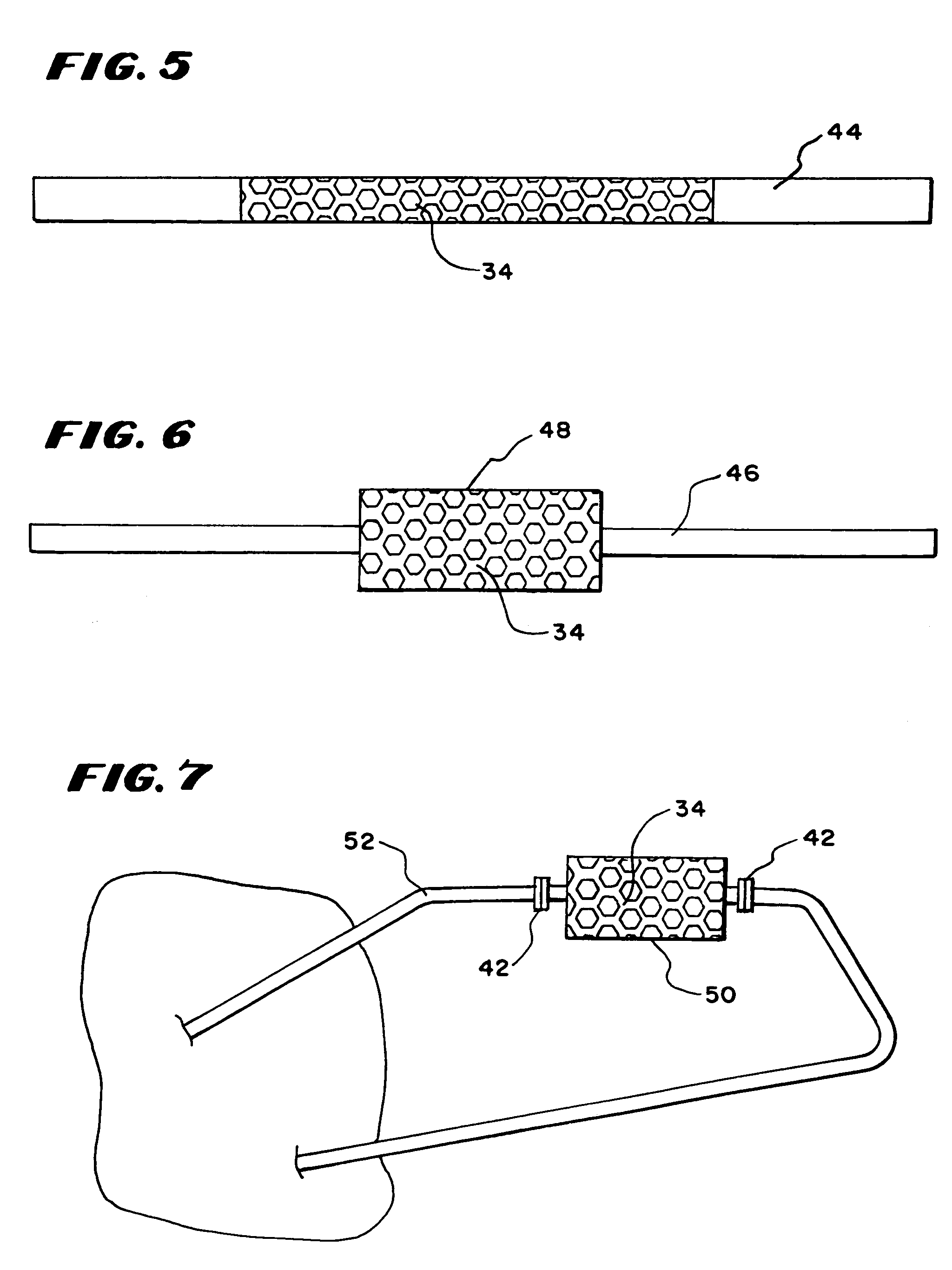 Devices, systems, and methods for reducing levels of pro-inflammatory or anti-inflammatory stimulators or mediators in the blood, generated as a result of extracorporeal blood processing