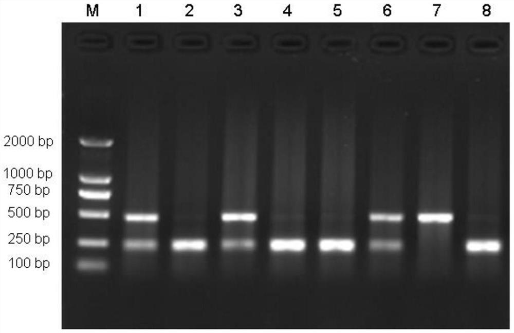 Detection method for correlation between GARNL1 gene and chicken breed testis traits and application