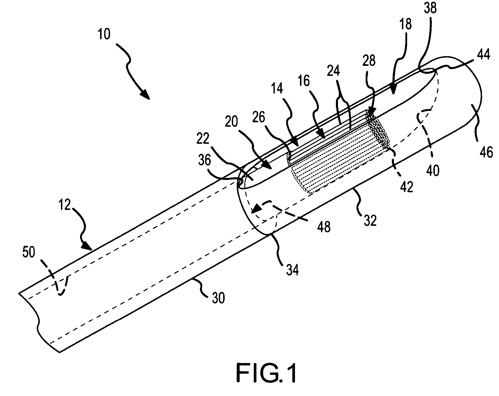 Side-port sheath for catheter placement and translation