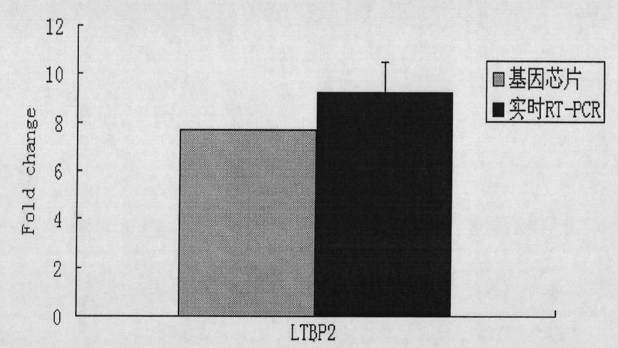 Application of LTBP-2 (Latent transforming growth factor beta binding protein 2) in preparation of cardiac failure test kit and kit containing LTBP-2