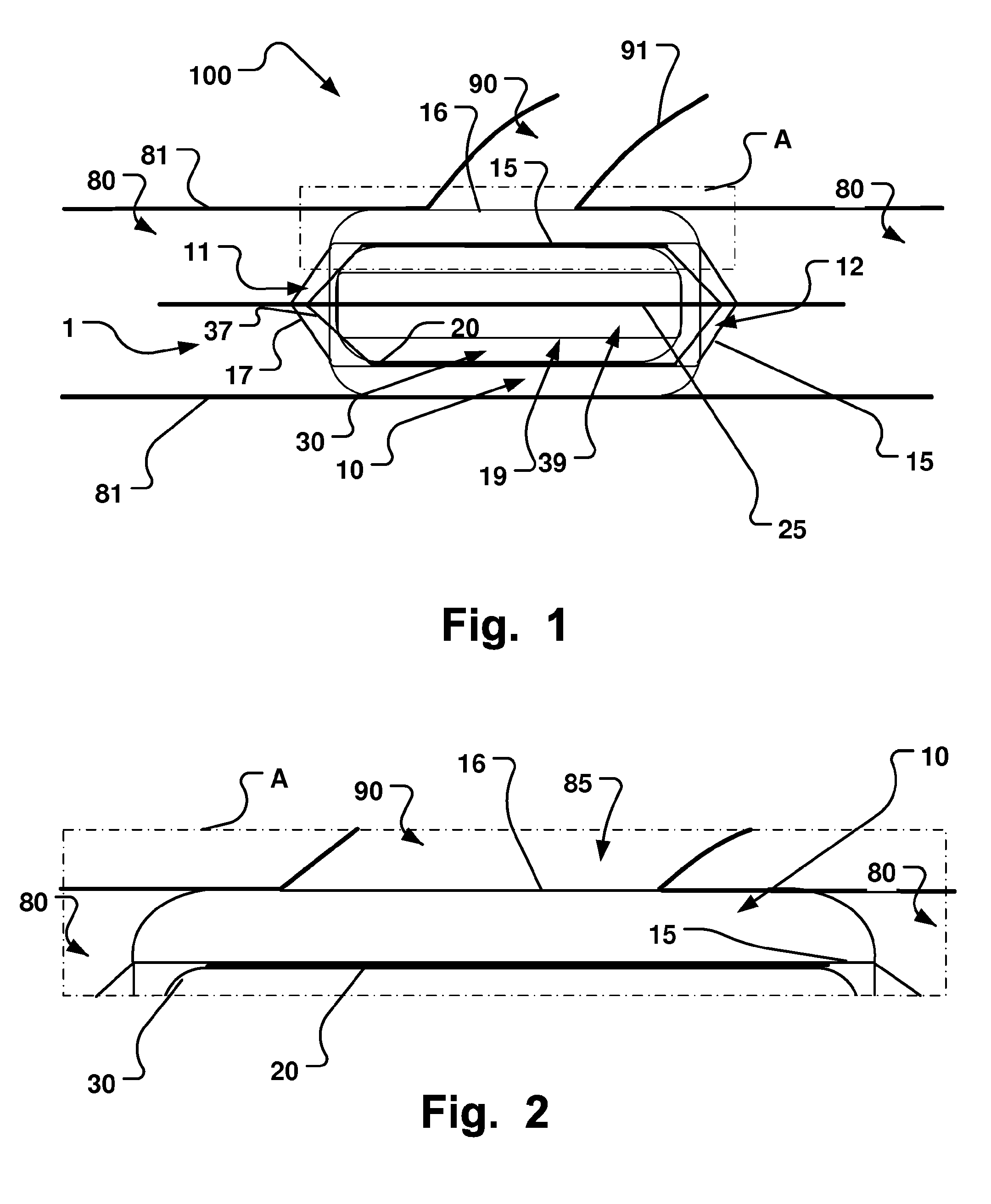 Medical Device, Method And System For Temporary Occlusion Of An Opening In A Lumen Of A Body