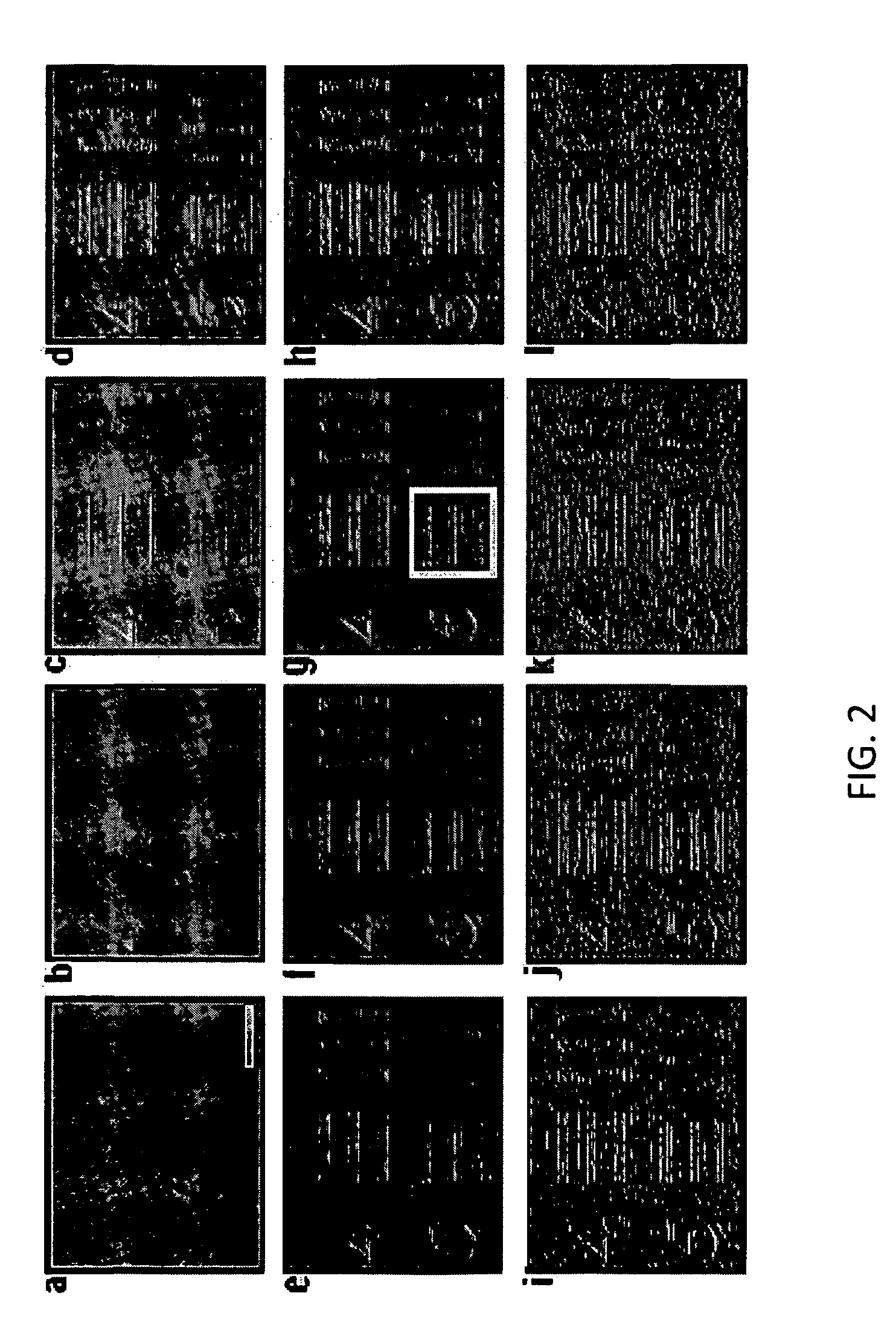 System and method for nonlinear self-filtering via dynamical stochastic resonance