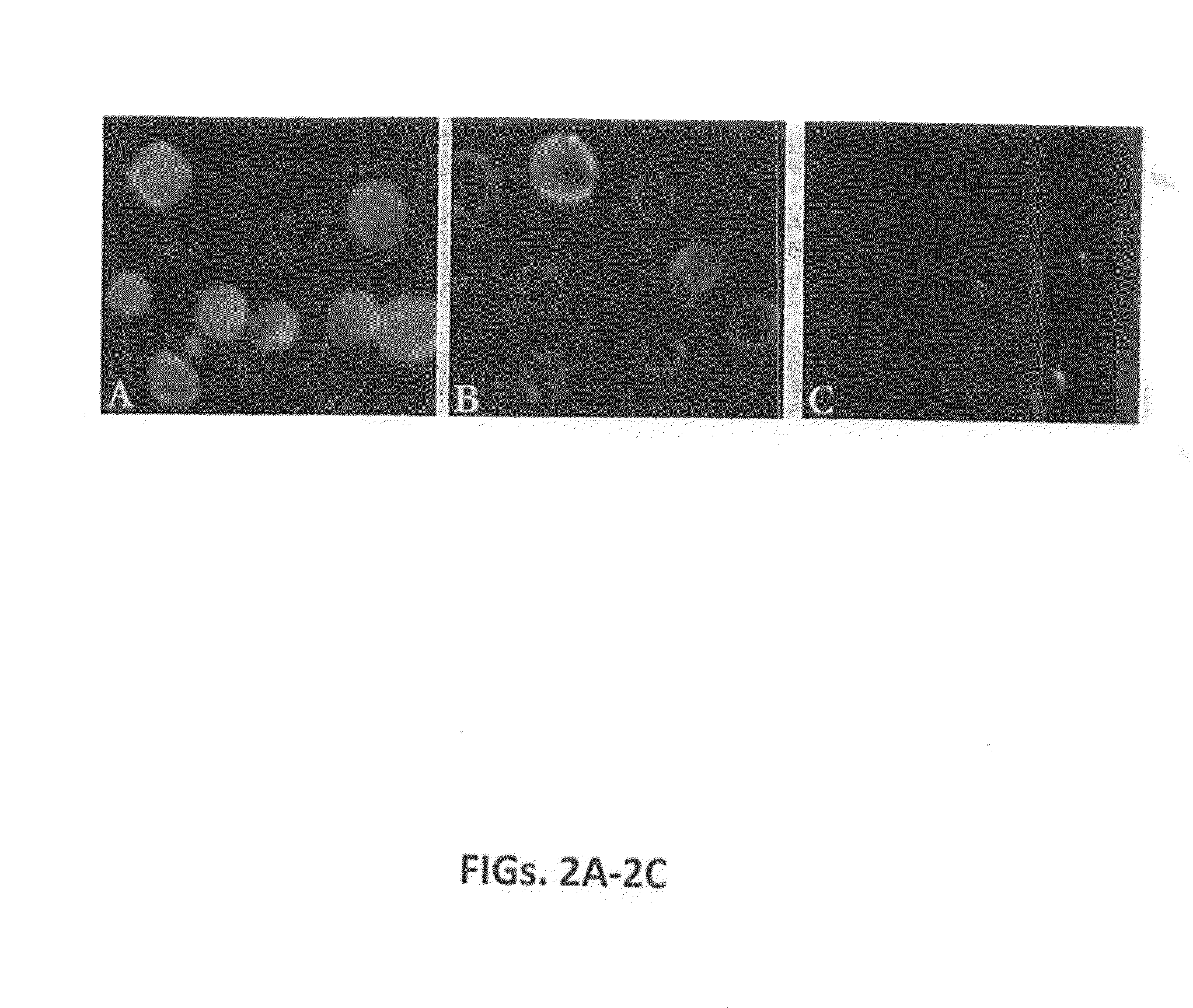 Pancreatic cancer associated antigen, antibody thereto, and diagnostic and treatment methods
