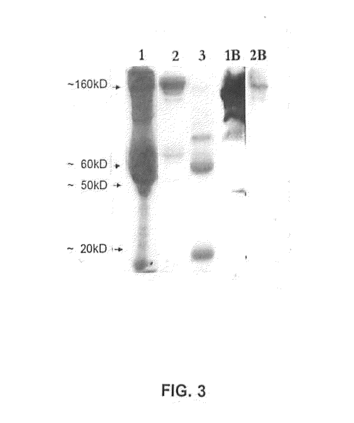 Pancreatic cancer associated antigen, antibody thereto, and diagnostic and treatment methods