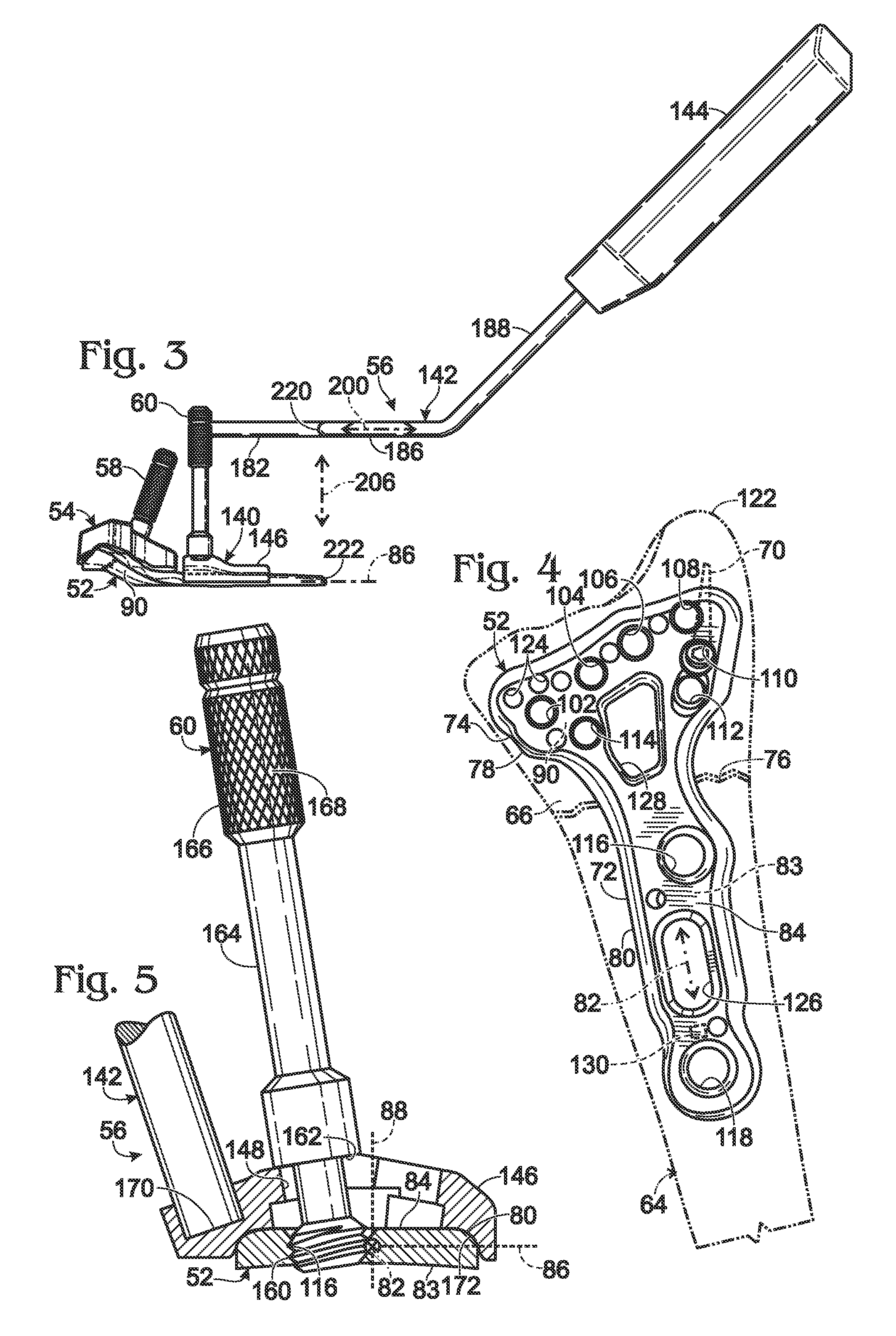 Targeting guide with a radiopaque marker to facilitate positioning a bone plate on bone