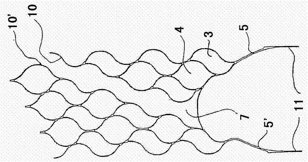 Thrombectomy equipment