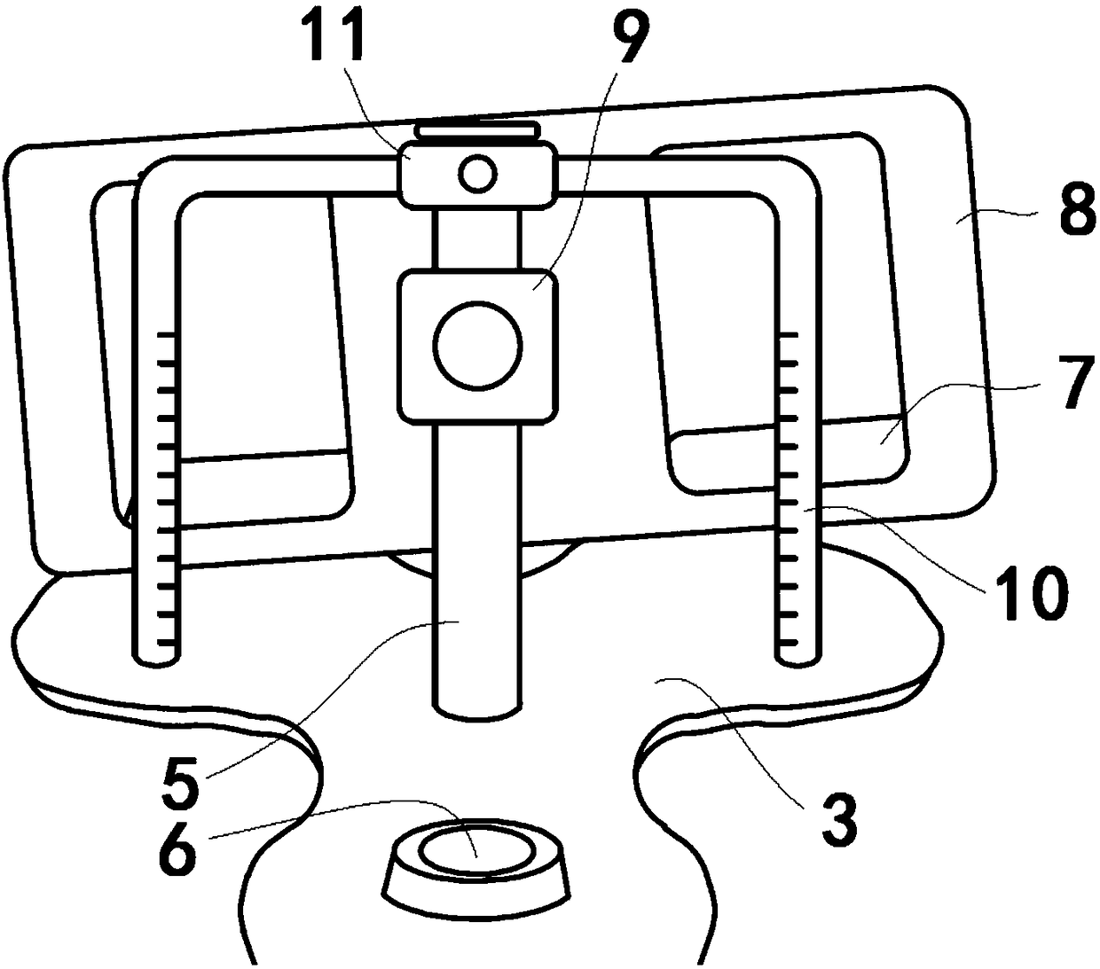 Auxiliary knee arthroplasty clearance balance tool