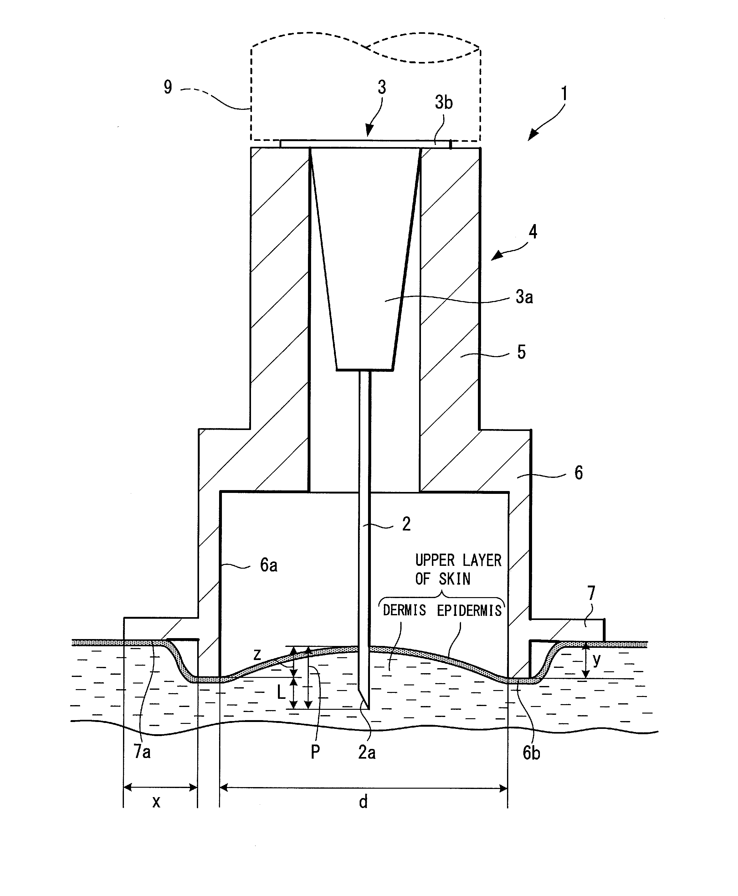 Injection needle assembly and drug injection device