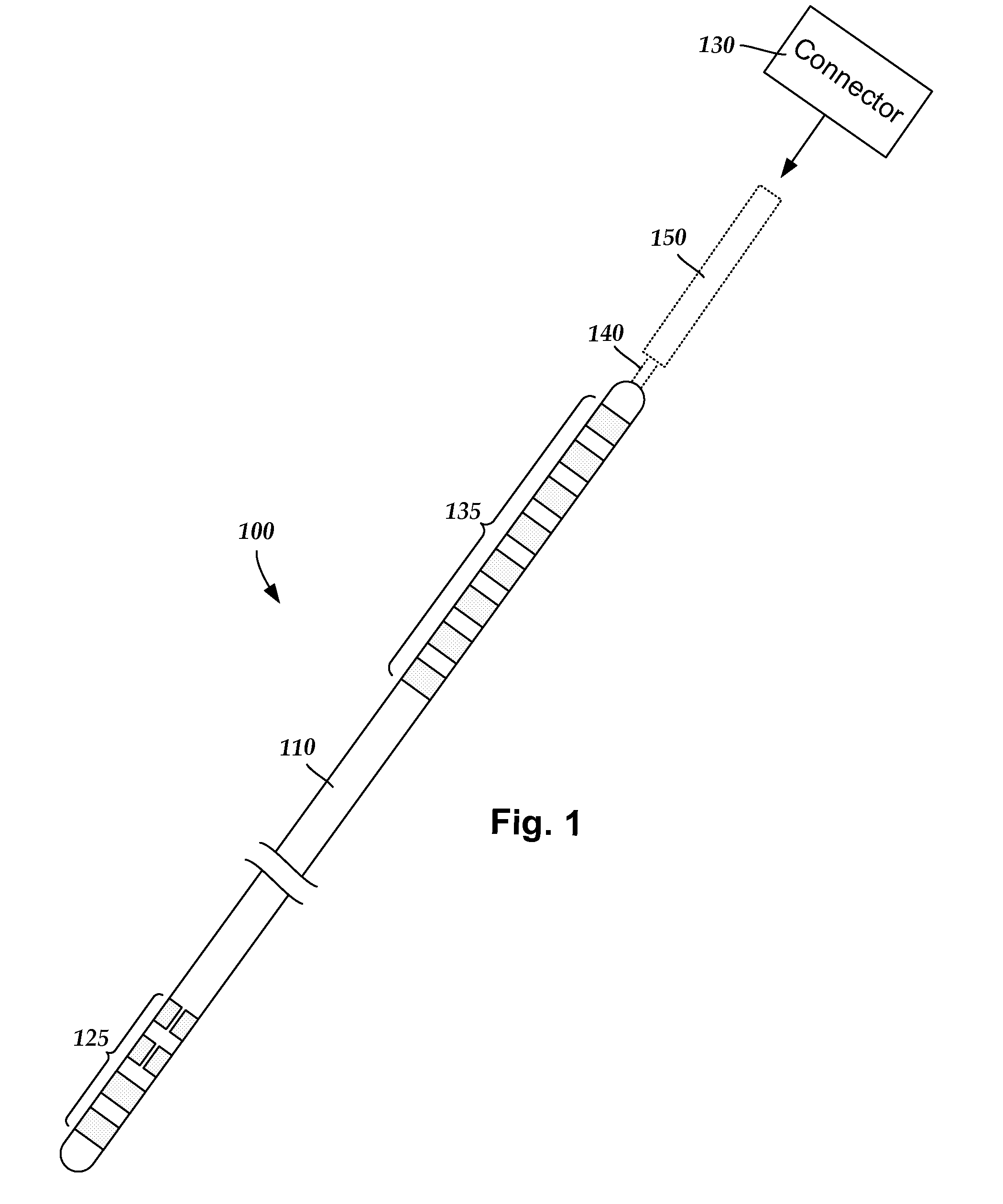 Systems and methods for making and using radially-aligned segmented electrodes for leads of electrical stimulation systems