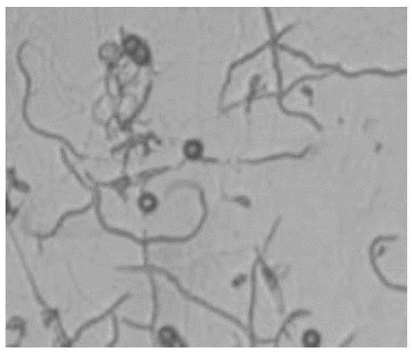 Method for infecting wheat by inoculating tilletia foetida to roots