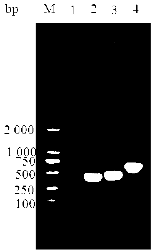 K99-987P-F41 recombinant protein and application thereof