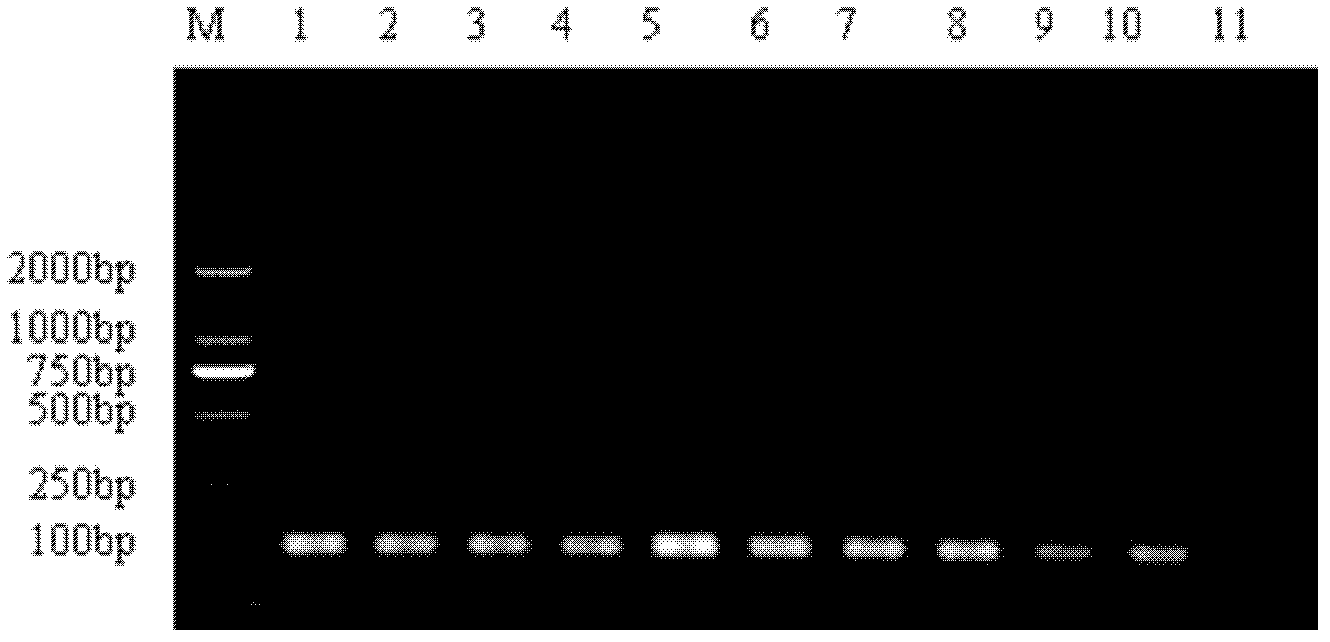 Kit for detecting Listeria monocytogenes and staphylococcus aureus, and application thereof