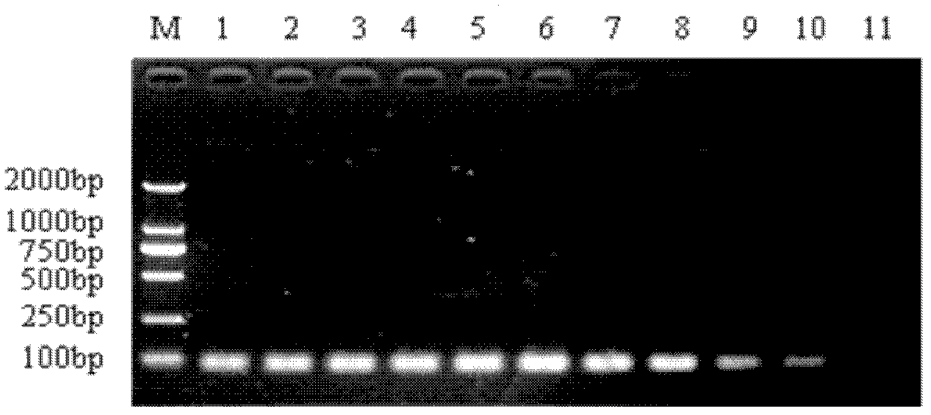 Kit for detecting Listeria monocytogenes and staphylococcus aureus, and application thereof