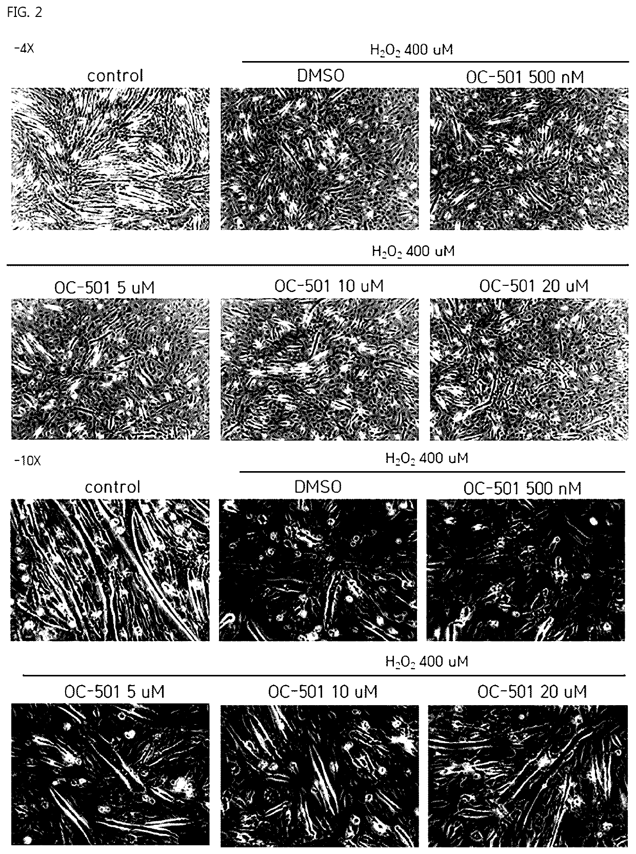 Composition for treatment of muscular disorders