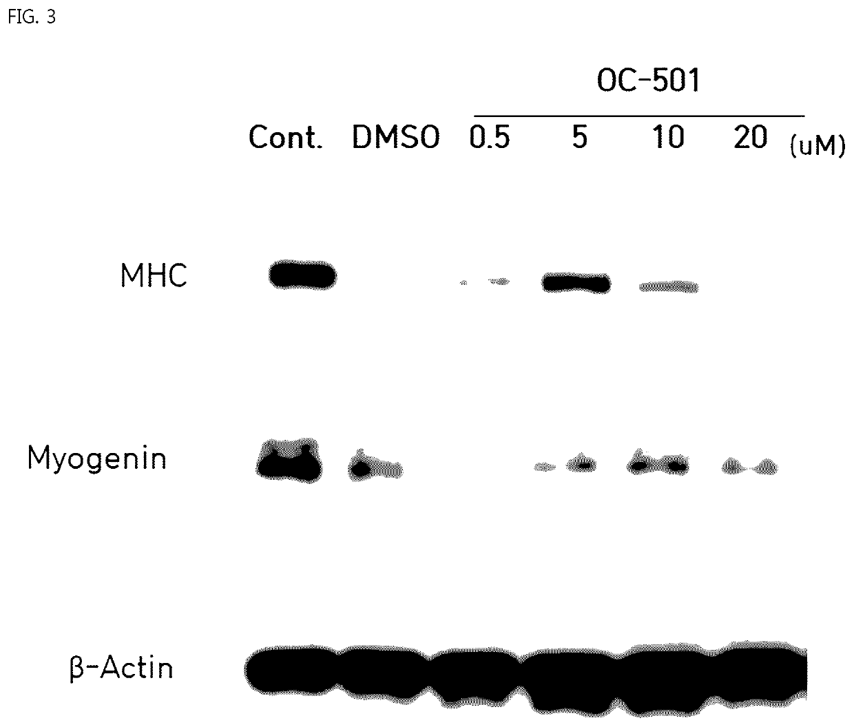 Composition for treatment of muscular disorders