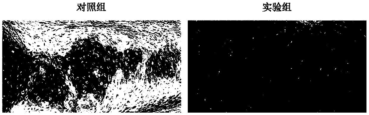 Regeneration method of cartilage.