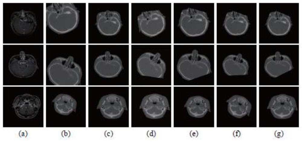 An Image Multimodal Registration Method Based on Asynchronous Deep Reinforcement Learning