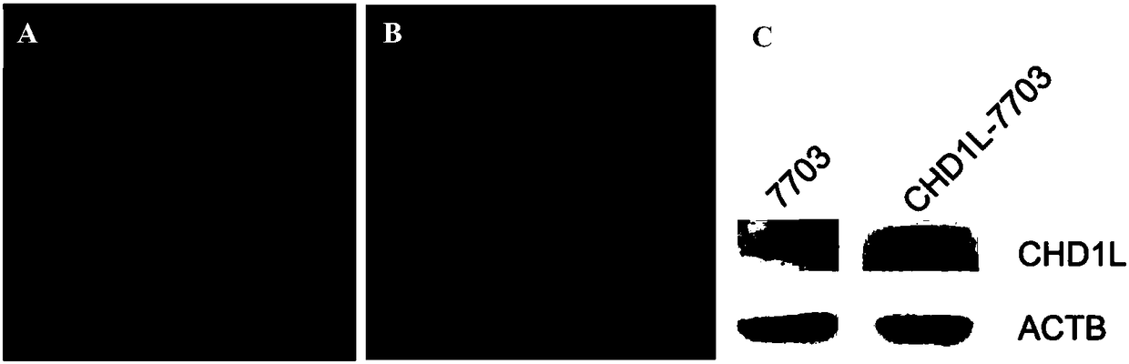 Construction method for hepatoma cell line for conditionally-induced knockout overexpressed Chd1l genes