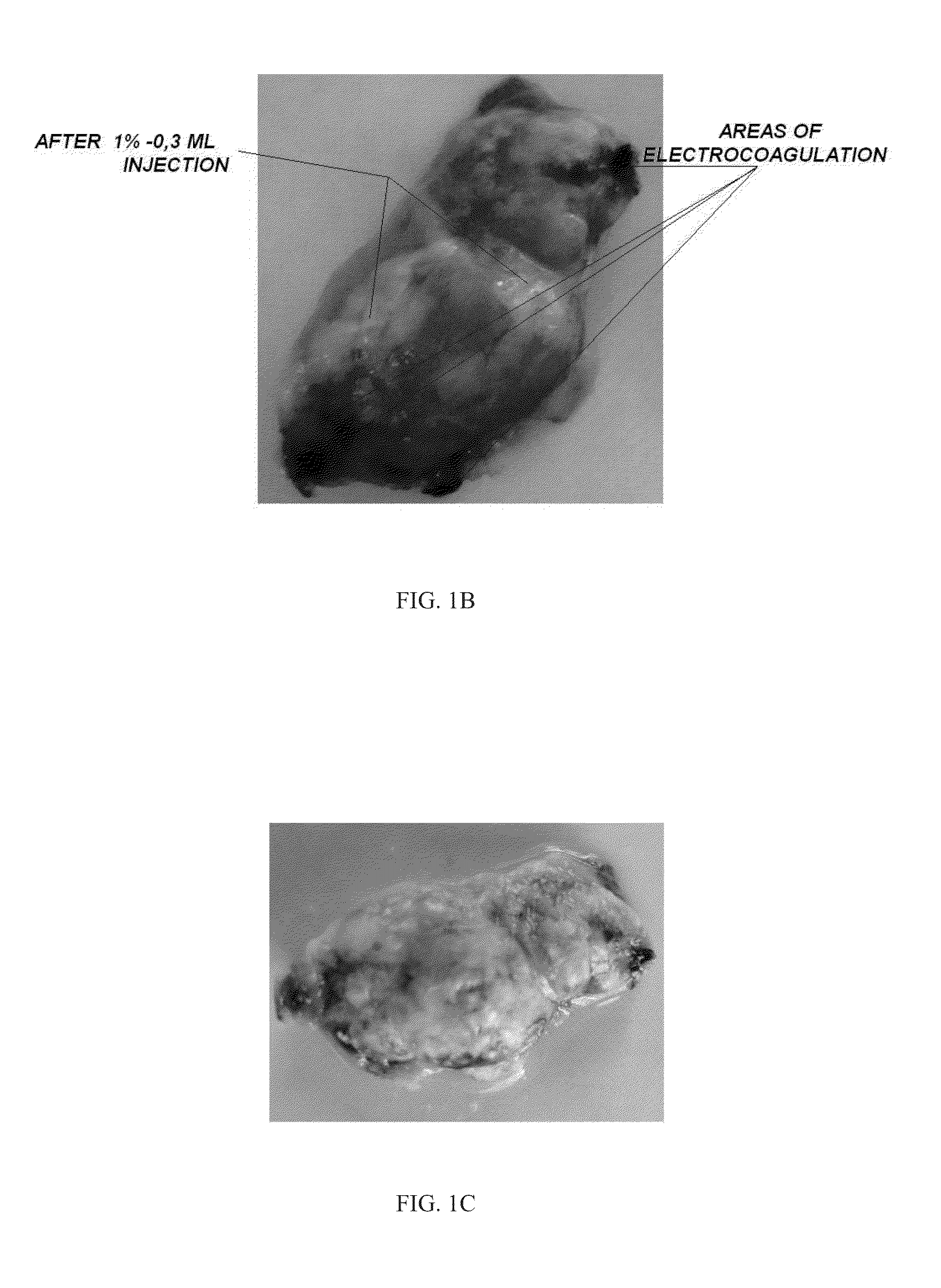 Halogenated aliphatic carboxylic acids, oligomers and/or polymers thereof and their use in devitalizing external and internal neoplasms
