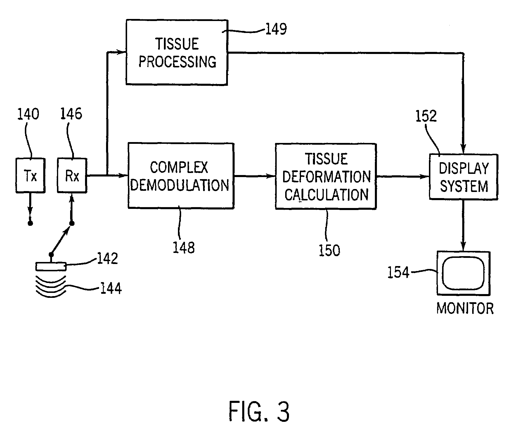 Method and apparatus for providing real-time calculation and display of tissue deformation in ultrasound imaging