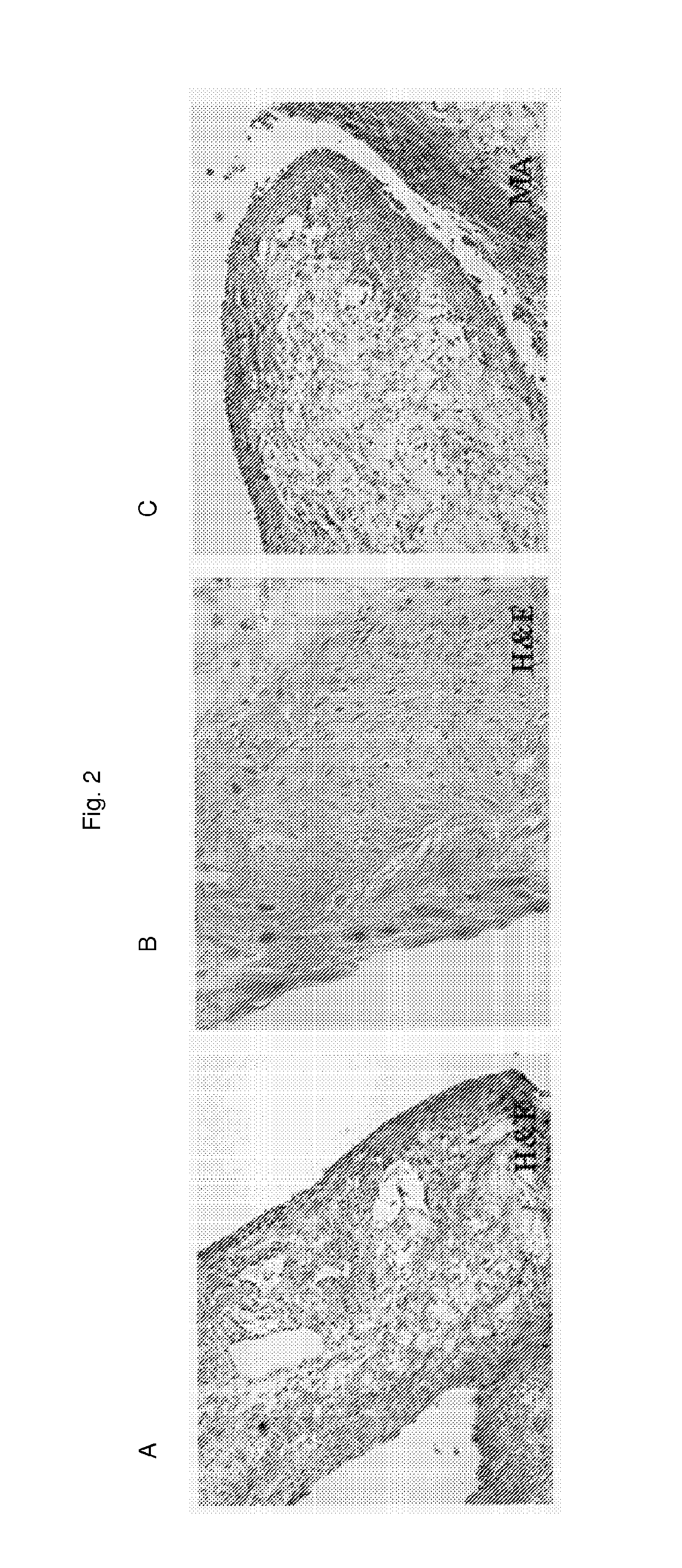 Tissue Engineering Using Pure Populations Of Isolated Non-Embryoblastic Fetal Cells