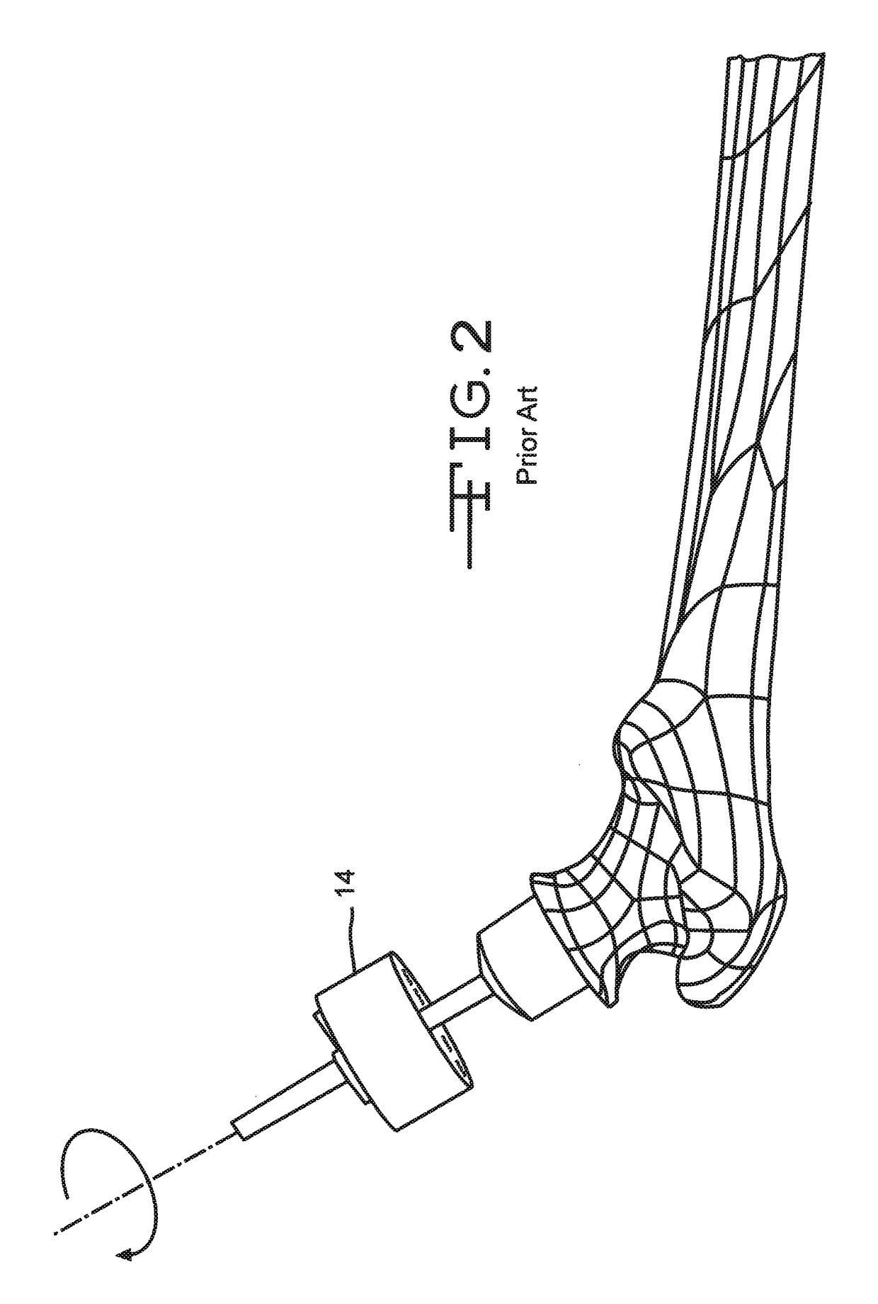 Instrument for reshaping the head of a femur