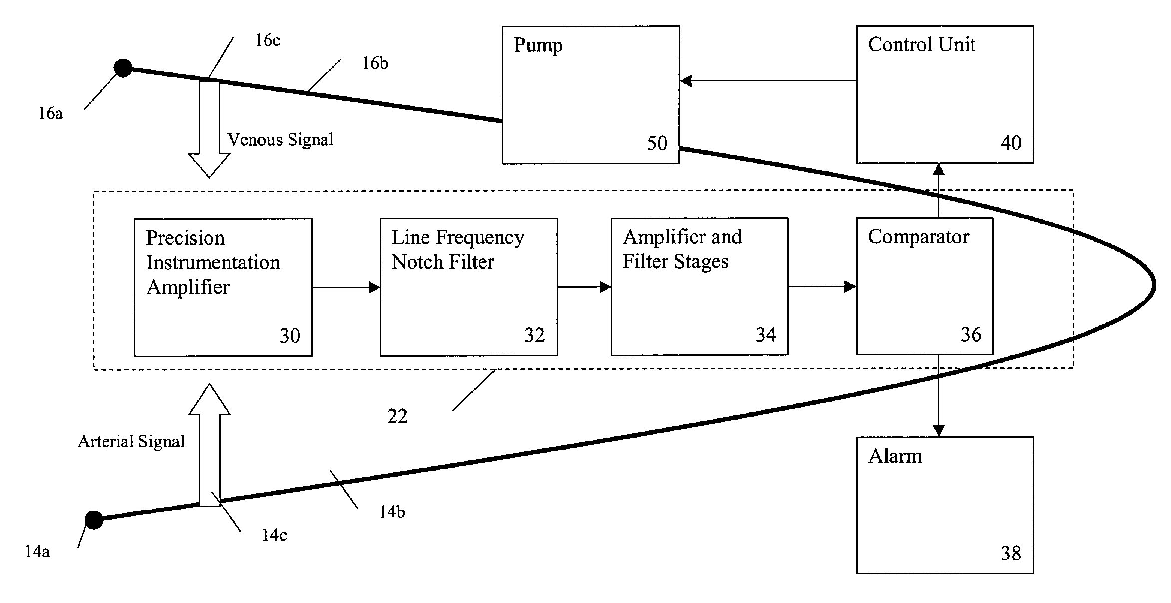 Method for detecting the disconnection of an extracorporeal device using a patient's endogenous electrical voltages