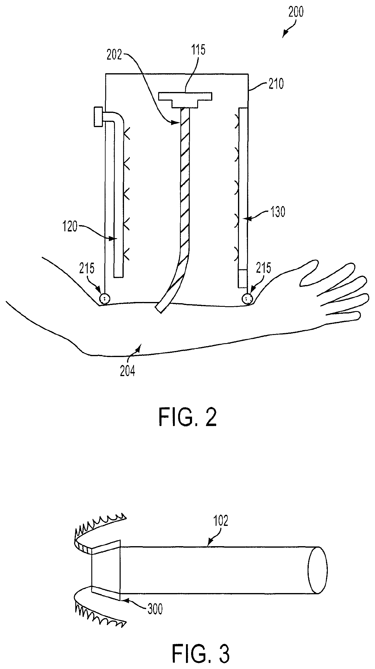 Vessel treatment systems, methods, and kits