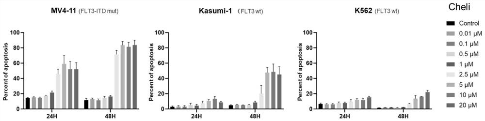 Application of chelidonine in preparation of medicine for treating acute myelogenous leukemia with FLT3-ITD mutation