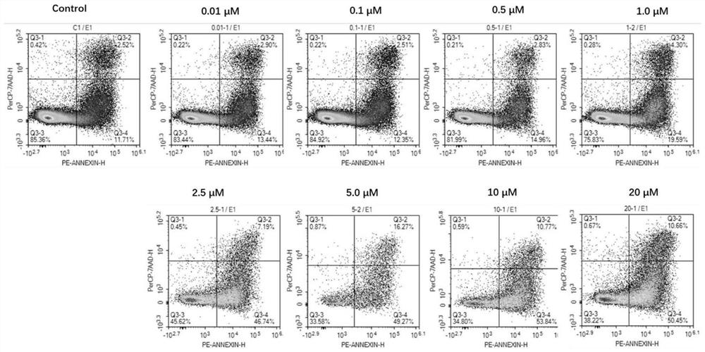 Application of chelidonine in preparation of medicine for treating acute myelogenous leukemia with FLT3-ITD mutation