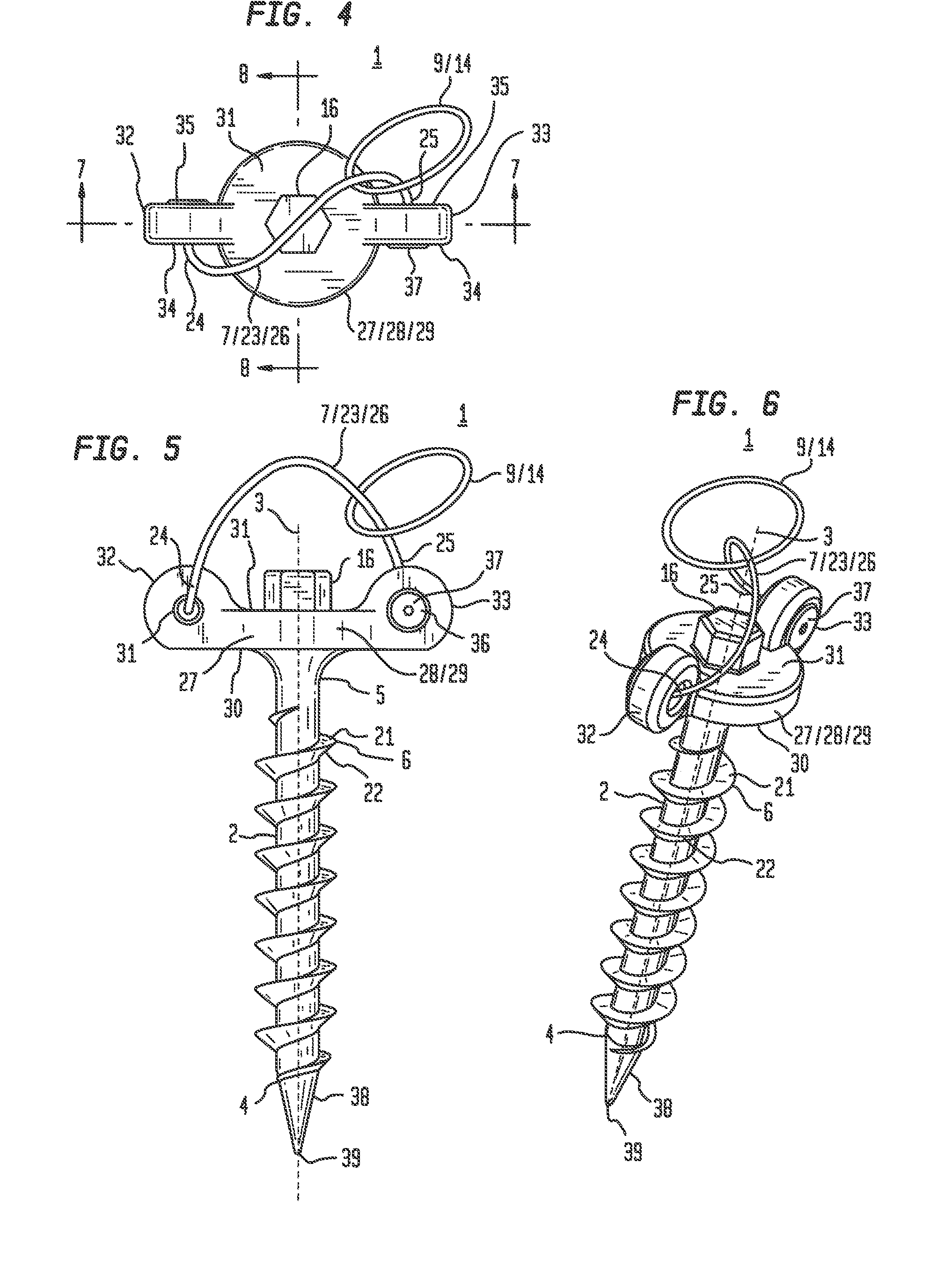 Anchor system