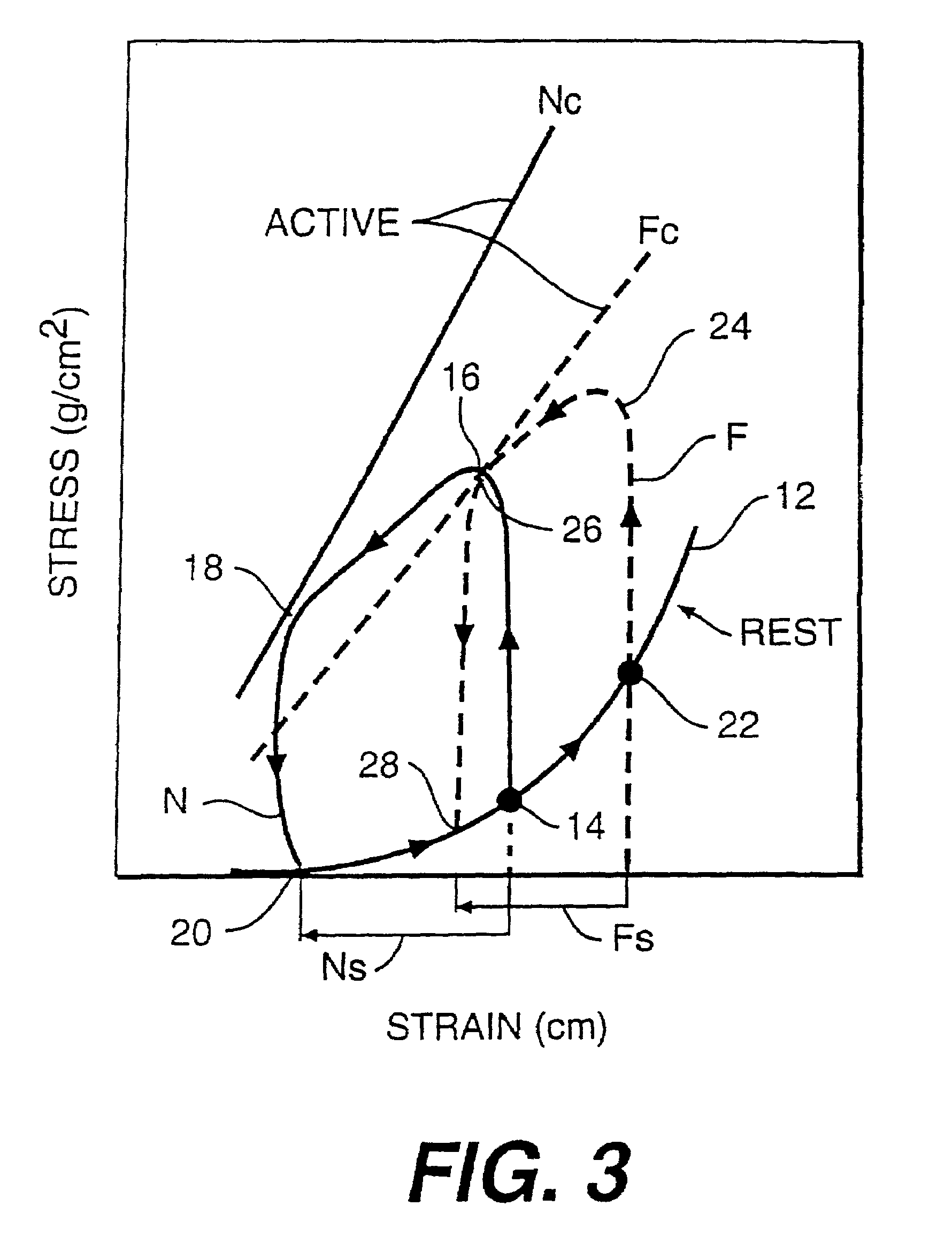 Heart wall tension reduction apparatus and method