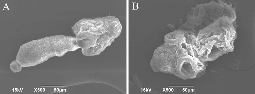 Application of cuminal in preparation of medicine for treating echinococcosis granulosa