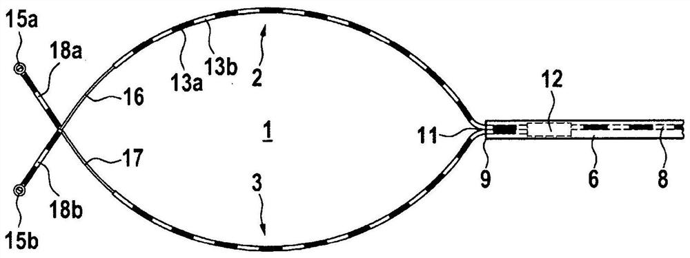 High Frequency Surgical Cutting Ring for Flexible Endoscopy